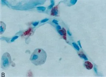 Anti-Surfactant Protein A antibody [6F10] used in IHC (Paraffin sections) (IHC-P). GTX60977