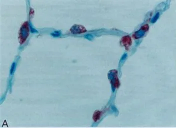 Anti-Surfactant Protein A antibody [6F10] used in IHC (Paraffin sections) (IHC-P). GTX60977