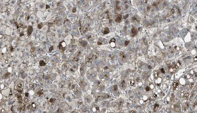 Anti-Vitronectin antibody [HV2] used in IHC (Paraffin sections) (IHC-P). GTX60980