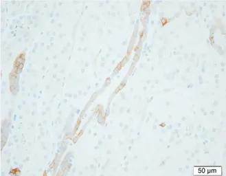Anti-ENaC Gamma antibody [5c2] (Biotin) used in IHC (Paraffin sections) (IHC-P). GTX60994-02