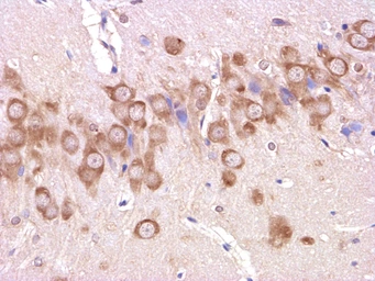 Anti-beta Amyloid (1-42) antibody used in IHC (Paraffin sections) (IHC-P). GTX60998
