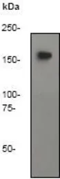 Anti-CD45 antibody [Y321] used in Western Blot (WB). GTX61210