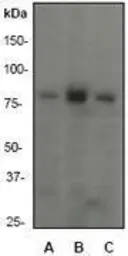 Anti-PI3 kinase p85 alpha antibody [EP380Y], C-term used in Western Blot (WB). GTX61304