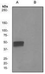 Anti-Tau (phospho Ser198) antibody [EPR2400] used in Western Blot (WB). GTX62137