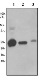 Anti-C1qC antibody [EPR2983] used in Western Blot (WB). GTX62147