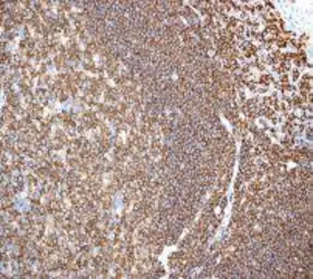 Anti-RIAM antibody [EPR2806] used in IHC (Paraffin sections) (IHC-P). GTX62255