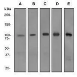Anti-RIAM antibody [EPR2806] used in Western Blot (WB). GTX62255