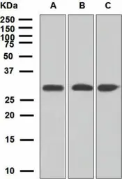 Anti-ING4 antibody [EP3804] used in Western Blot (WB). GTX62655