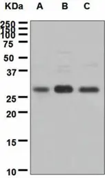 Anti-ING4 antibody [EP3804] used in Western Blot (WB). GTX62655