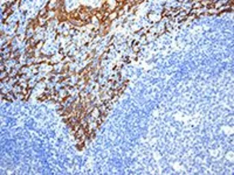 Anti-Cytokeratin 14 antibody [EPR1612] used in IHC (Paraffin sections) (IHC-P). GTX62683