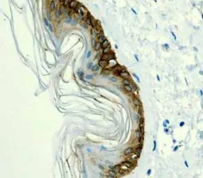 Anti-Cytokeratin 14 antibody [EPR1612] used in Immunohistochemistry (IHC). GTX62683