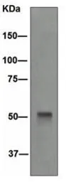 Anti-Cytokeratin 14 antibody [EPR1612] used in Western Blot (WB). GTX62683