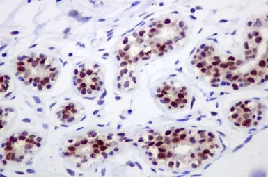 Anti-IKK alpha antibody [EPR464] used in IHC (Paraffin sections) (IHC-P). GTX62710