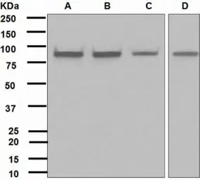 Anti-IKK alpha antibody [EPR464] used in Western Blot (WB). GTX62710