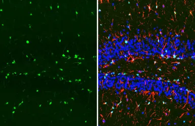 Anti-SOX2 antibody [GT1352] used in IHC (Paraffin sections) (IHC-P). GTX627405