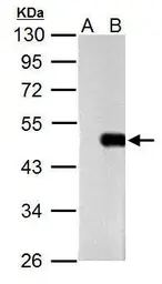 Anti-Oct4 antibody [GT735] used in Western Blot (WB). GTX627423
