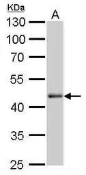 Anti-Oct4 antibody [GT735] used in Western Blot (WB). GTX627423