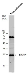 Anti-Lin28A antibody [GT717] used in Western Blot (WB). GTX628138
