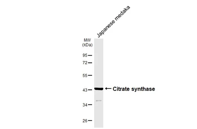 Anti-Citrate synthase antibody [GT2061] used in Western Blot (WB). GTX628144