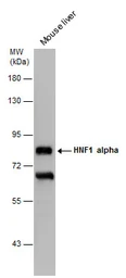 Anti-HNF1 alpha antibody [GT4110] used in Western Blot (WB). GTX628240