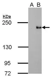 Anti-TET3 antibody [GT334] used in Western Blot (WB). GTX628257