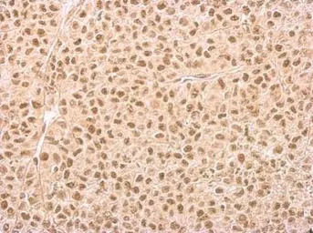 Anti-IP6K1 antibody [GT10611] used in IHC (Paraffin sections) (IHC-P). GTX628258