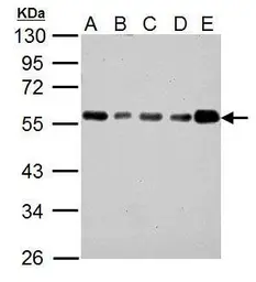 Anti-IP6K1 antibody [GT10611] used in Western Blot (WB). GTX628258