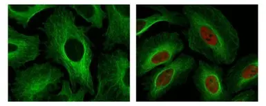 Anti-HIF1 alpha antibody [GT10211] used in Immunocytochemistry/ Immunofluorescence (ICC/IF). GTX628480