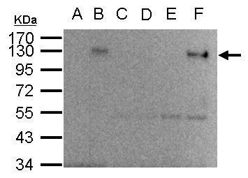 Anti Hif1 Alpha Antibody Gt10211 Gtx628480 Genetex