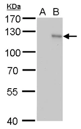 Anti-HIF1 alpha antibody [GT10211] used in Western Blot (WB). GTX628480