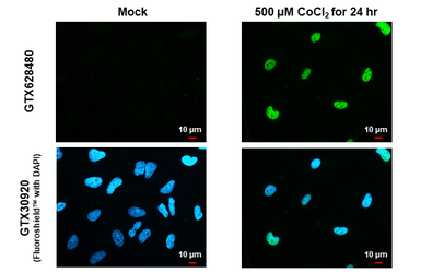 Anti-HIF1 alpha antibody [GT10211] used in Immunocytochemistry/ Immunofluorescence (ICC/IF). GTX628480