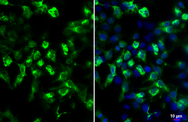 Anti-HA tag antibody [GT423] used in Immunocytochemistry/ Immunofluorescence (ICC/IF). GTX628489