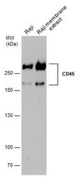 Anti-CD45RA antibody [GT0014] used in Western Blot (WB). GTX628507