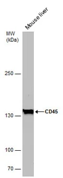 Anti-CD45RA antibody [GT0014] used in Western Blot (WB). GTX628507