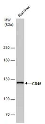 Anti-CD45RA antibody [GT0014] used in Western Blot (WB). GTX628507