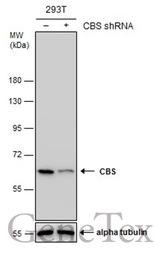 Anti-CBS antibody [GT519] used in Western Blot (WB). GTX628777