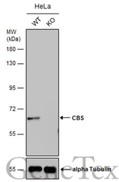 Anti-CBS antibody [GT519] used in Western Blot (WB). GTX628777