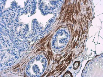 Anti-Transgelin antibody [GT336] used in IHC (Paraffin sections) (IHC-P). GTX628831