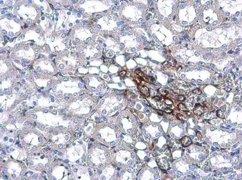 Anti-Transgelin antibody [GT336] used in IHC (Paraffin sections) (IHC-P). GTX628831