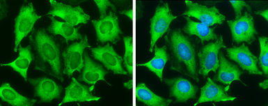 Anti-Transgelin antibody [GT336] used in Immunocytochemistry/ Immunofluorescence (ICC/IF). GTX628831