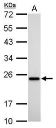 Anti-Transgelin antibody [GT336] used in Western Blot (WB). GTX628831