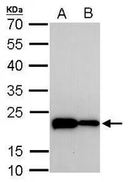 Anti-Transgelin antibody [GT336] used in Western Blot (WB). GTX628831