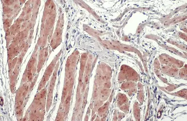 Anti-Transgelin antibody [GT336] used in IHC (Paraffin sections) (IHC-P). GTX628831