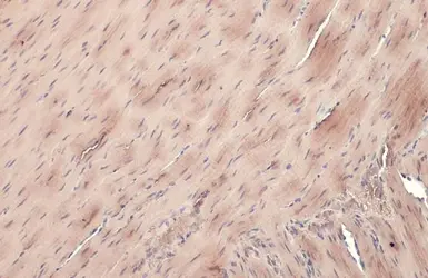 Anti-Transgelin antibody [GT336] used in IHC (Paraffin sections) (IHC-P). GTX628831