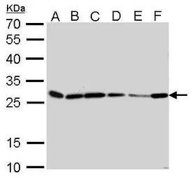 Anti-HMGB1 antibody [GT383] used in Western Blot (WB). GTX628834