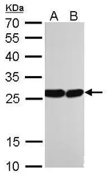 Anti-HMGB1 antibody [GT383] used in Western Blot (WB). GTX628834