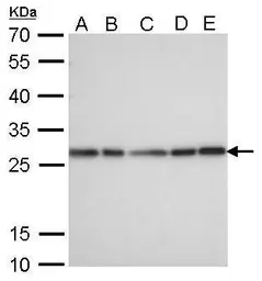 Anti-HMGB1 antibody [GT383] used in Western Blot (WB). GTX628834