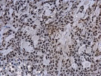 Anti-PARP antibody [GT6212] used in IHC (Paraffin sections) (IHC-P). GTX628836
