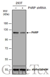 Anti-PARP antibody [GT6212] used in Western Blot (WB). GTX628836