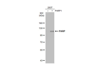 Anti-PARP antibody [GT6212] used in Western Blot (WB). GTX628836